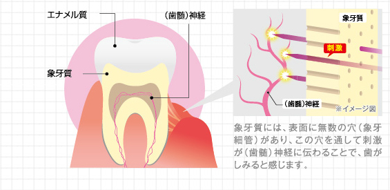 歯の構造と知覚過敏