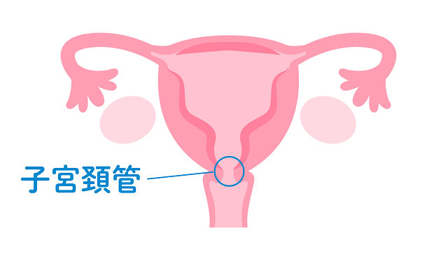 子宮頸がん発症部位