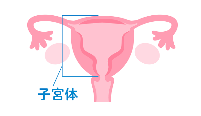 子宮体がん発症部位